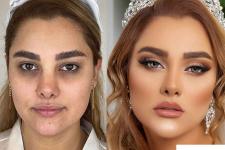 تصویر بند انگشتی قبل و بعد