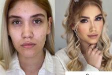 تصویر بند انگشتی قبل و بعد آرایش