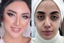 تصویر بند انگشتی قبل و بعد آرایش مدیوم